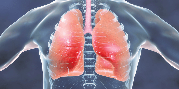 Respiratory disorders